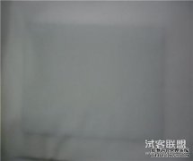 有人知道腰椎纤维炎吗？它会引起屁股疼痛吗？